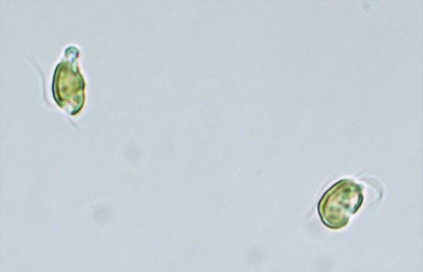 Golden algae is seen in a microscopic image. Picture courtesy of the Florida Fis