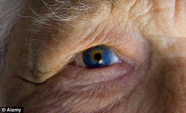 老年性黄斑变性导致英国四分之一60岁群体和二分之一70岁群体视力下降