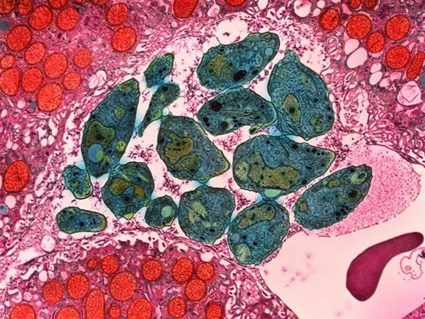 A colored transmission electron micrograph (TEM) of Toxoplasma gondii parasites