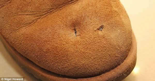 英国一女子街头抓拍狐狸遭反击