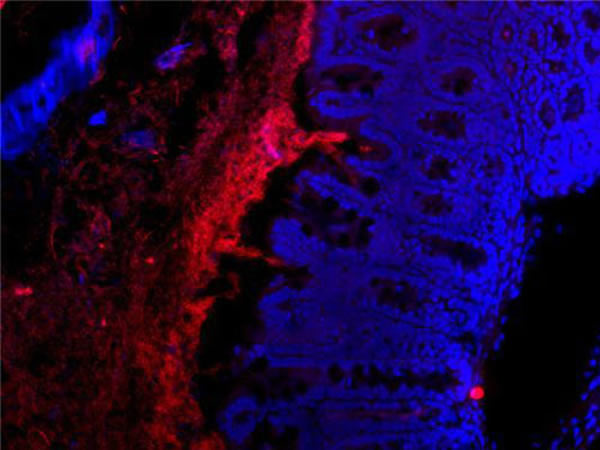 新研究称人体肠道内(蓝色部分)的有益细菌(红色部分)可预防糖尿病