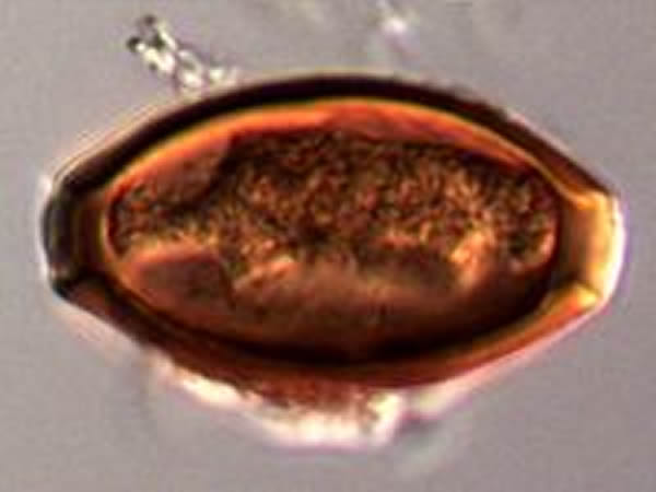 A whipworm egg harbors dangerous larvae.