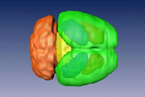 根据核磁共振成像对老鼠大脑进行的3D模型重建