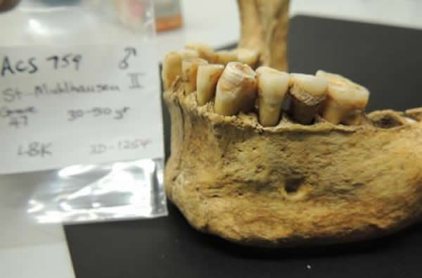 �Թ�������ʯ�б�����ϸ��DNA���о�