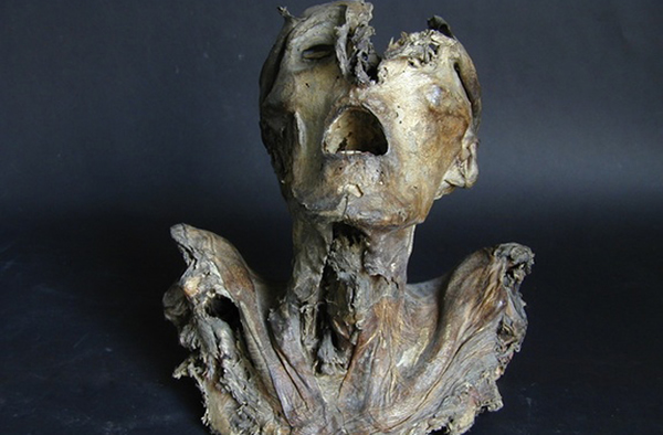 This anatomical specimen dating to the 1200s is the oldest known in Europe.