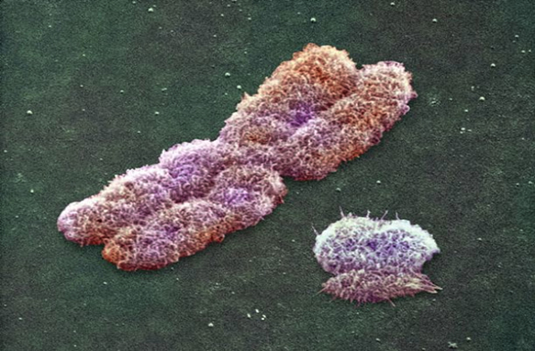 X and Y chromosomes, with the smaller Y chromosome to the right