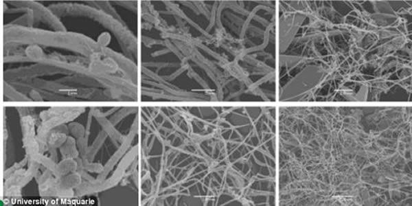 ��΢���¹۲조���Ƕ�Ѩ������������Ⱥ���Ҵ�����������ˮ���������̬ϵͳ��������ȫ����