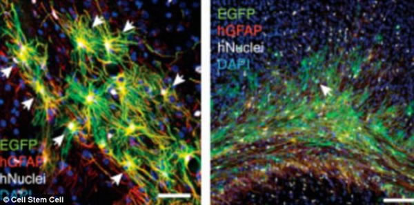 ��ѧ��ʹ����΢�����ֲ������������ེ��ϸ����ͼ����ɫ���������ེ��ϸ��