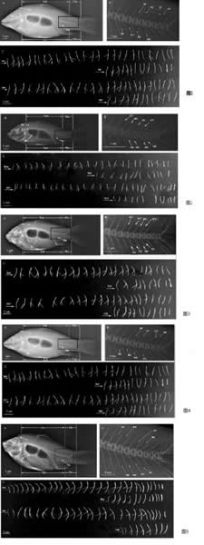 �����Ŵ������ķ�����Ӱ�켡����γɷ��淢���ش�����