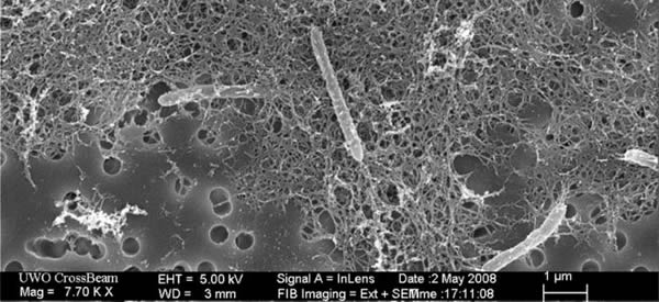 Most intriguing of all is the microbe Desulforudis Audaxviator that dwells nearl