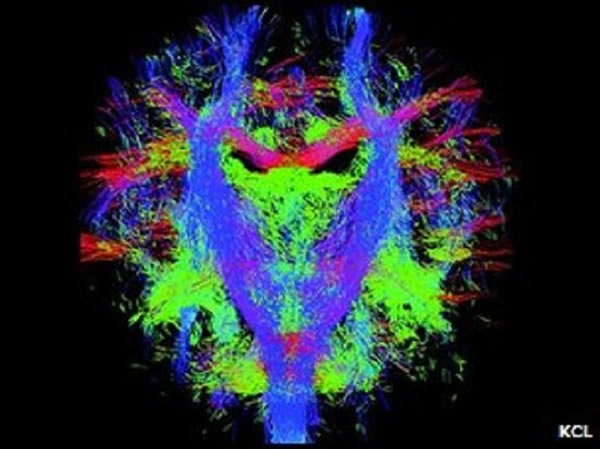 ��ѧ�ҳ������ܹ���׼ȷ�Ĳ�׽�������������е�����ά����