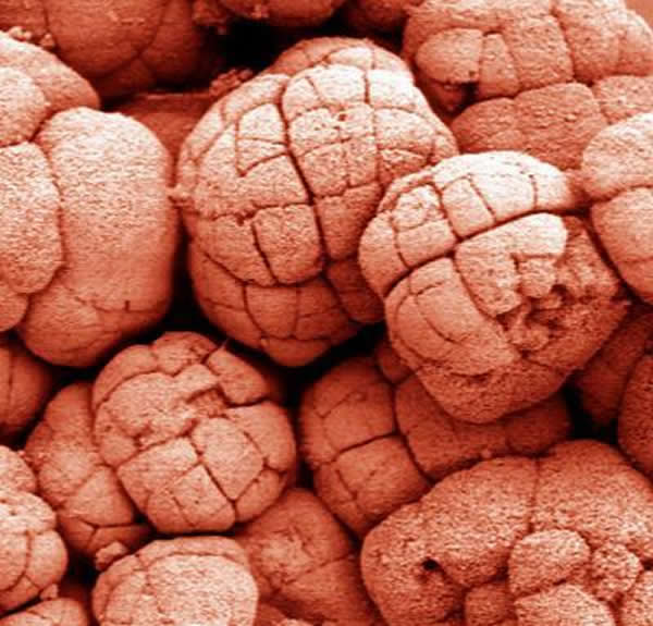 该照片(视野宽度约0.15毫米)显示了来自中国南方陡山沱地层(距今6.35亿年至5.51亿年)的保存得极为出色的真核生物化石。来自陡山沱地层的高分辨率地球化学数