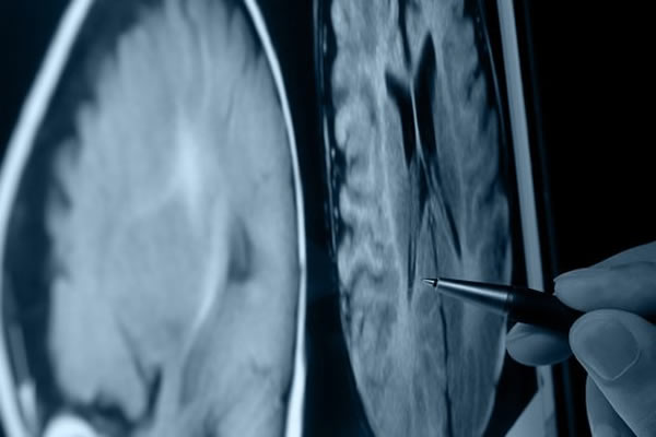 �Ŵ�ѧ���Ѿ��ɹ�����ͨ��ϸ��ת���Ϊһ���򼲲����ٵĴ���ϸ����