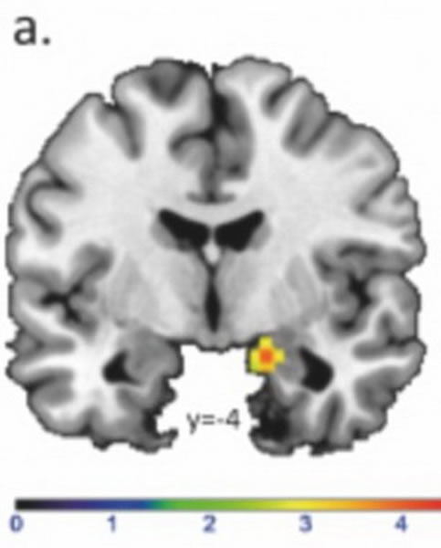 �˴Ź���ɨ��ͼ����ʾ������ʶ�����Ů�������仯�������ϲ���Ѷ��Ǹ������������仯������