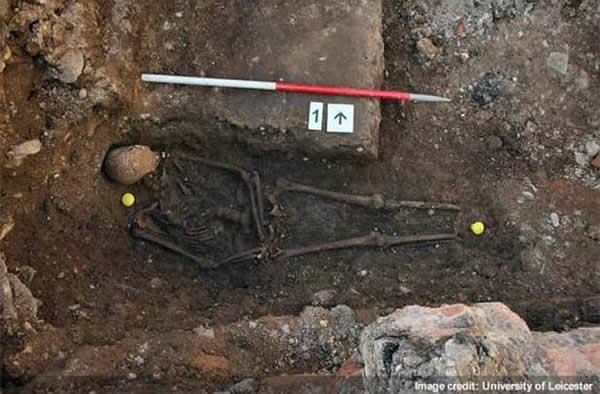 The remains of what may be King Richard III, showing a curved spine and signs of