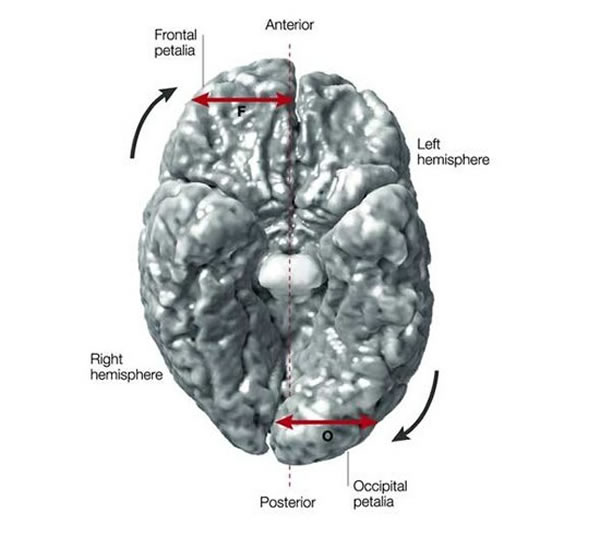 大脑非对称性的三维视图