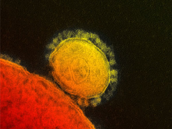 �ж�����ϵͳ�ۺ�����״������MERS-CoV virus��