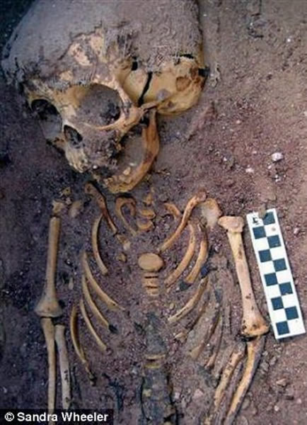 女童的上身骨骼,该考古研究证实古埃及存在着虐待儿童的现象