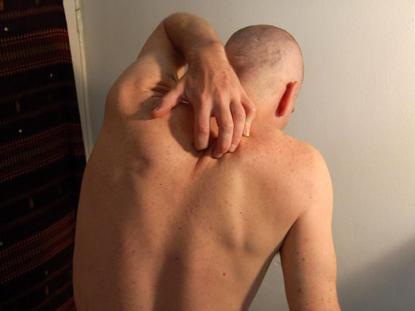 ����Ƥ��������ԭ��