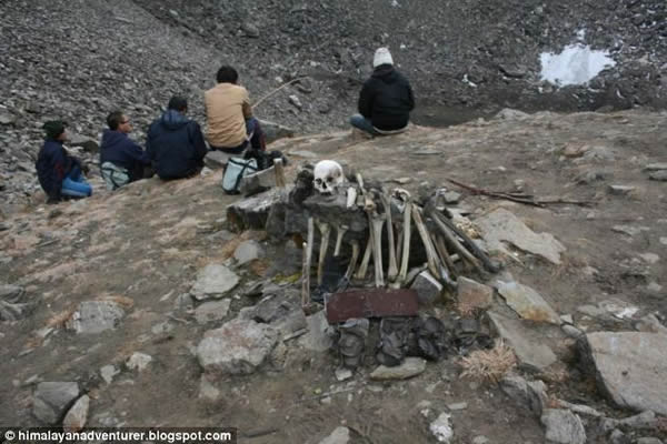 �ҿ�ӡ�ȱ������˹Ǻ���֮��