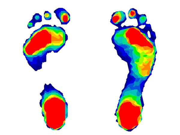 A comparison of two human footprints.