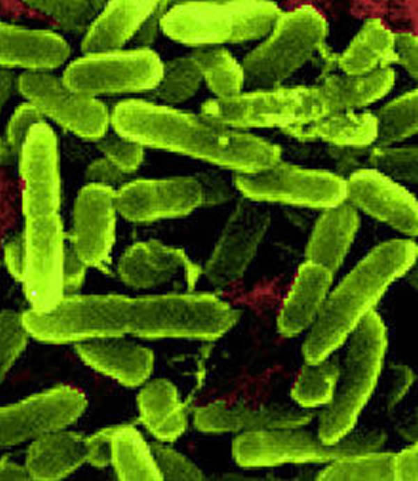 绿脓杆菌样品被使用人工尿液进行培养，并形成一种独特的“茎-盖”结构，这是在地球上所未见的