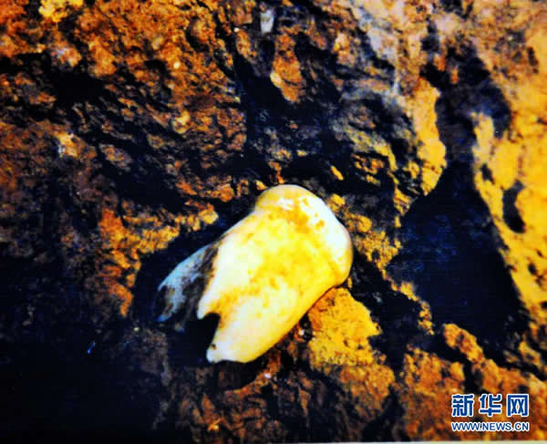 ԱôᶴֵľԳݻʯ2008914Ƭ