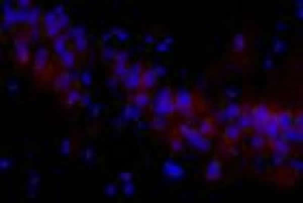 �����Ҵ���¶�������������֯��ϸ�������Ե��׼�ø5ӫ��Ⱦɫ����Ԫ�����϶�(����ӫ�⣬��400)