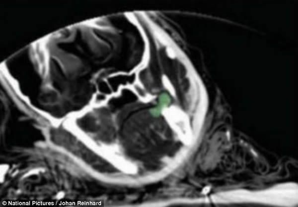 嘴巴内部轴向X光照片显示牙齿之间的古柯叶(绿色部分)。古柯叶和酒精是引发交替状态的物质,这被认为是神圣的,它向受害人以及与受害人相关的人们暗示着神的亲近。