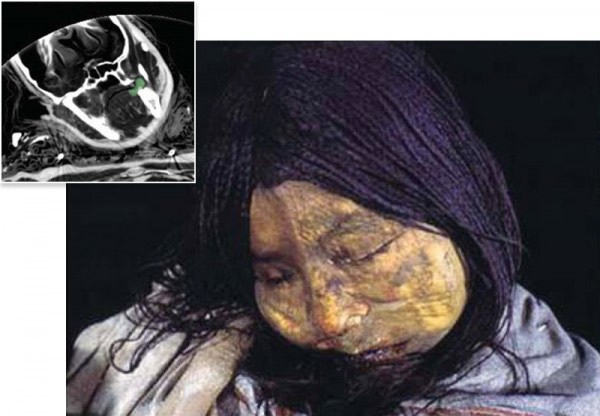 印加儿童木乃伊或为活人祭品