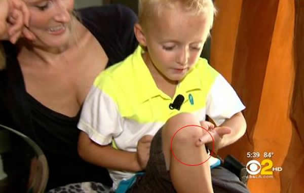 ����4���к�ϥ���С�����������ţ