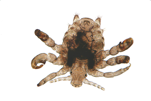 世界最丑动物之一——阴虱