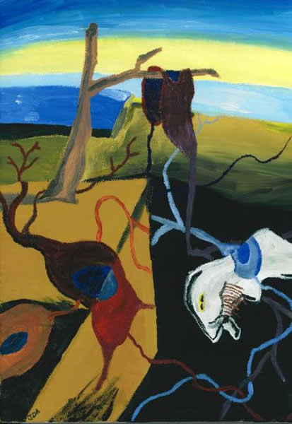 艺术演绎的在阿尔茨海默氏病带来的发生退化神经元和记忆丧失