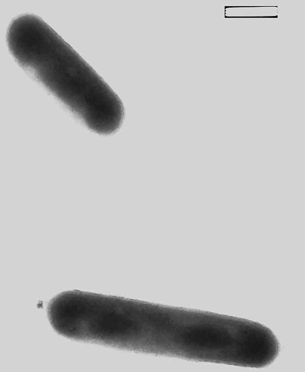 电子显微镜下的以氨为食的古生菌。