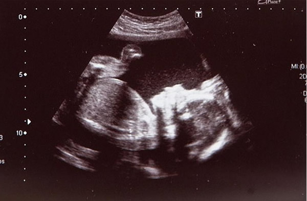 ���������ﾹȻ����һֻѼ��