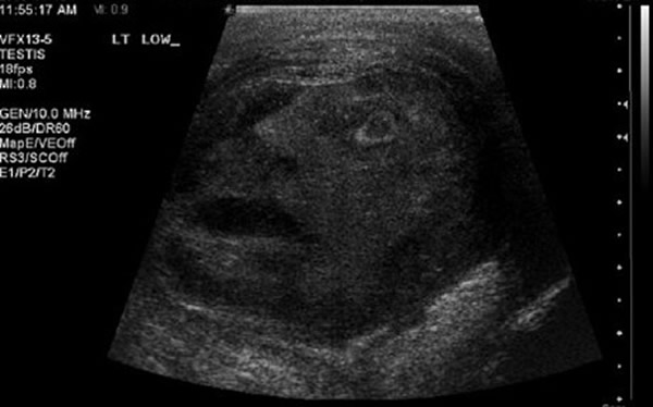 ���ܳ���������غ�裬��Ƭ�к�Ȼ��һ�š���������