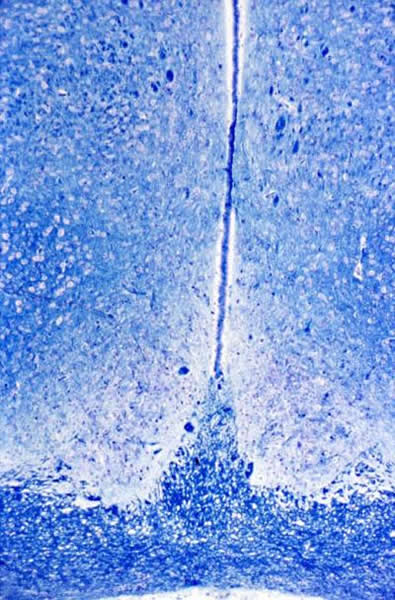 视交叉上核或SCN的局限于背视交叉