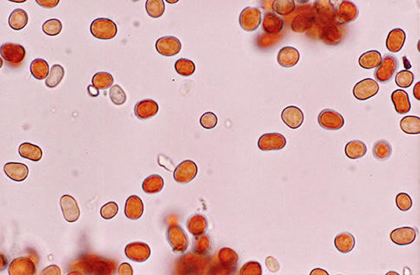 �����ﾹ����ϸ��״�ṹ