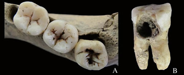 ����Ȫ��ʯ��ʱ������ȣ�ݲ��䣬A���ʳ�ҧ����ȣ�ݣ�B���ʳݽ�����ȣ�ݡ������۹�ͼ��