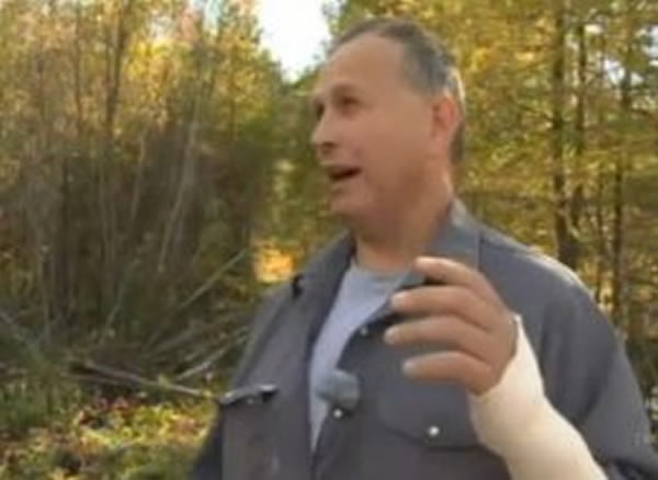 加拿大男子在树林里遭遇黑熊袭击,抓住熊舌头逃过一劫