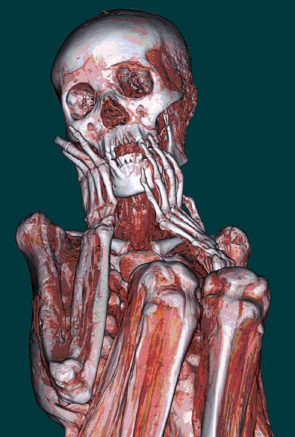 一种新技术使破译古人类DNA成本更低