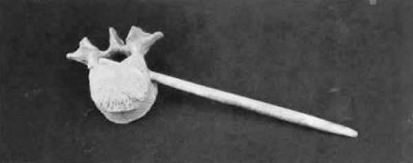 ���ǲ�����ڹ���ڶ���׵��