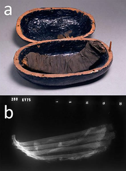 Mmm, ribs. This rack of beef was mummified and placed in the tomb of Egyptian no