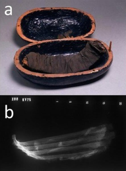 古埃及坟墓中用作来世食物的“木乃伊肉类”经过了复杂的处理进行保存