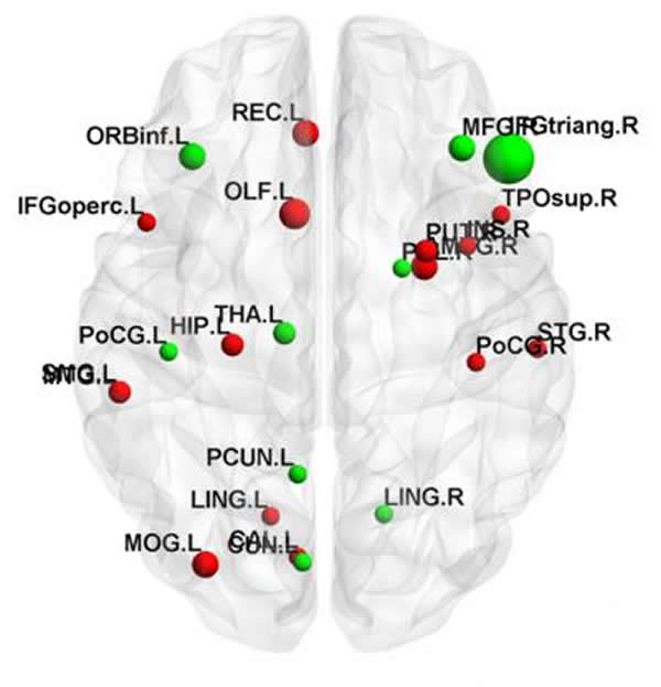 ֪ϰ֪ϰ߾Ϣ̬ԹмĶȴڲĽڵ㡣ɫʾ֪ϰмĶȻ߽ڵЧֵ֪ϰ