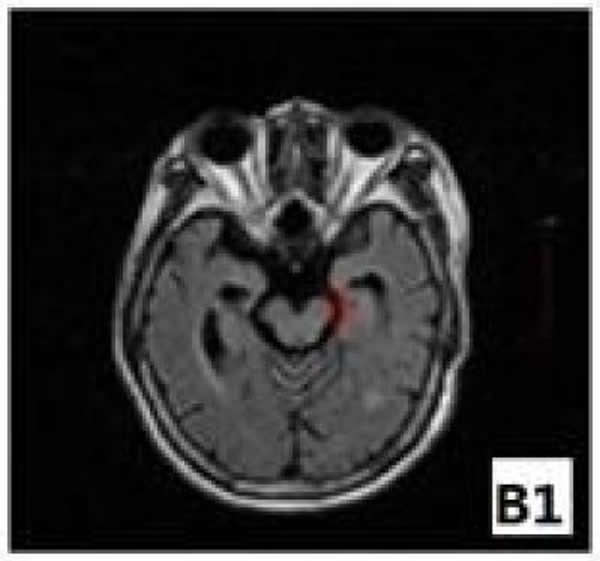 �Ź�������ʾ���˶��շ���λ�����Թ������߻�����Խ�����ڲ���6����ʱ�Ѿ����ִ��Խ������С