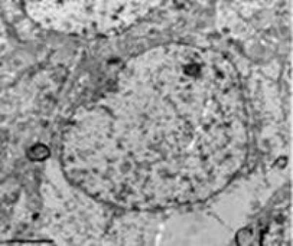 עdl-3n̪˴ĴƤϸԼᣬĤƽԽϺã̬򣬴нܹɣʿ