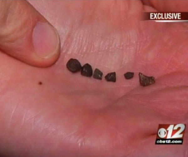 美国7岁小男孩被陨石砸到头