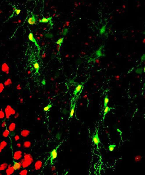 宾夕法尼亚州立大学研究人员在生物学家陈功教授领导下已经开发了一个全新的技术来再生功能性神经元用于脑损伤或脑疾病后的大脑修复。这项技术有望发展成为一个崭新的治疗脑