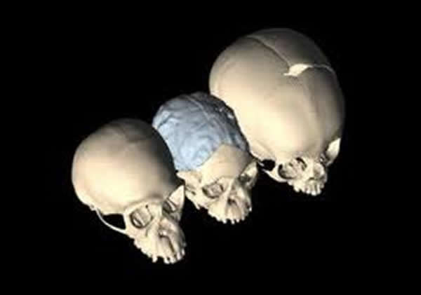 ͬΪ4��ĺ����ɣ��󣩡��Ϸ���Գ��������ͯ�����У����ִ���­���������